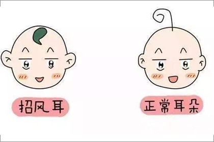 招風(fēng)耳.jpg