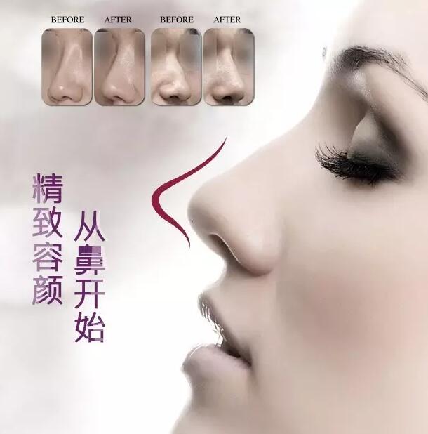 精致容顏,從鼻開始