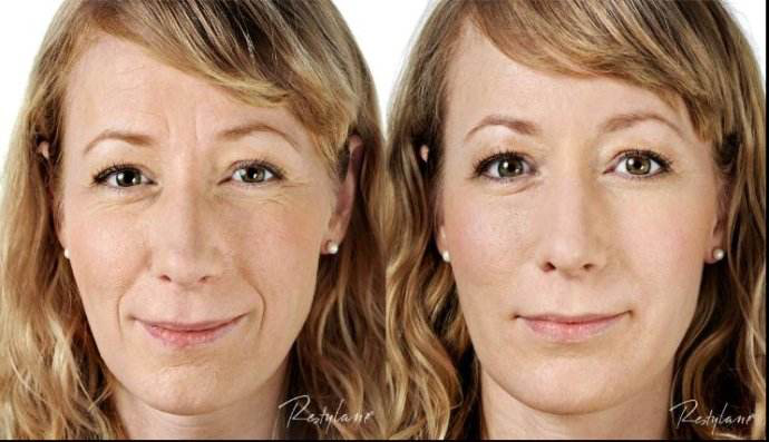 醫(yī)療美容心理學(xué)08