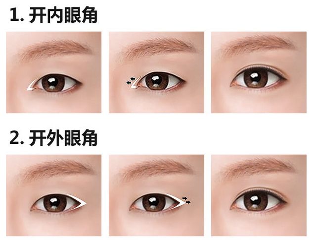 開內(nèi)眼角.jpg
