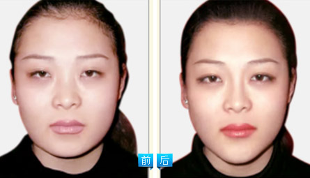 墊下巴——尤小姐