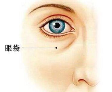 眼袋.jpg