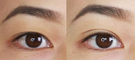 雙眼皮做法.jpg