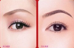 仿生植眉——劉小姐