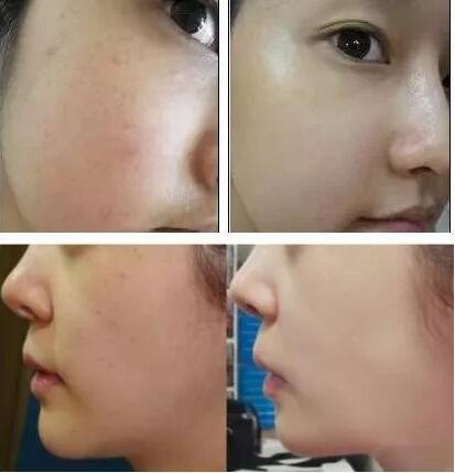 情人節(jié)活動-海南整形5